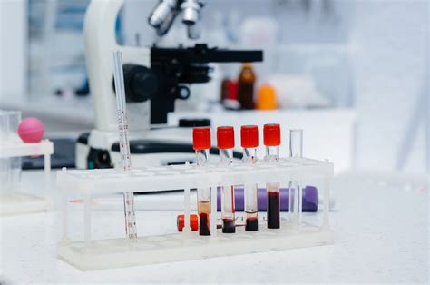 analysis laboratory near me|pathology blood test near me.